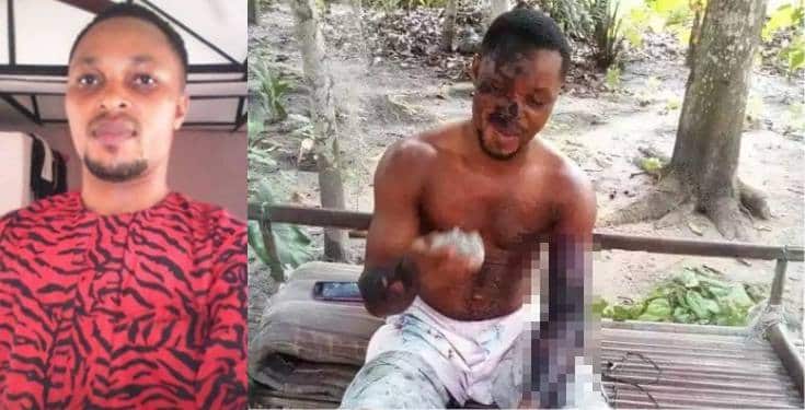 Jealous lady scalds her boyfriend with hot water In Rivers State