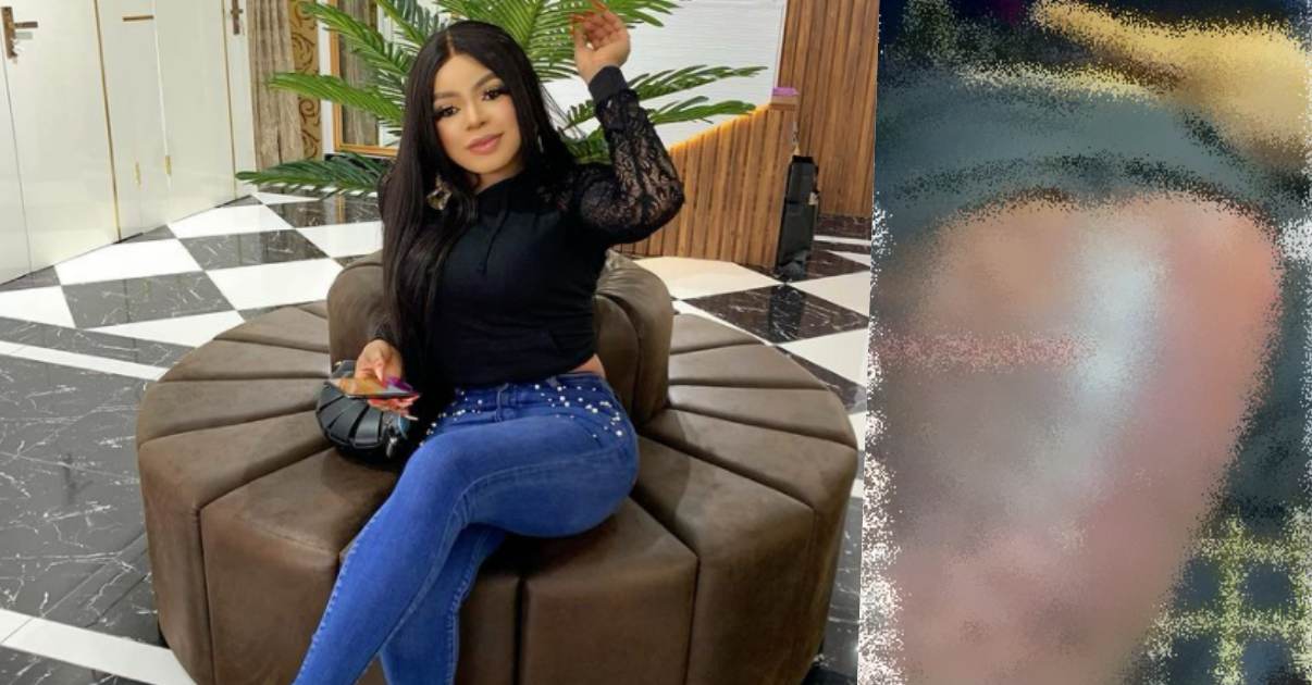 Leaked video of Bobrisky's alleged 'infected' butt surgery surfaces