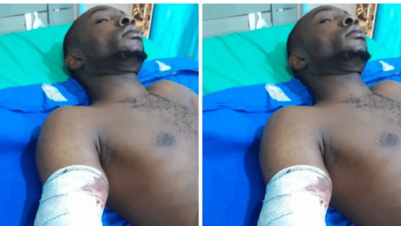 Industrial machine cuts off worker's hand in Ogun