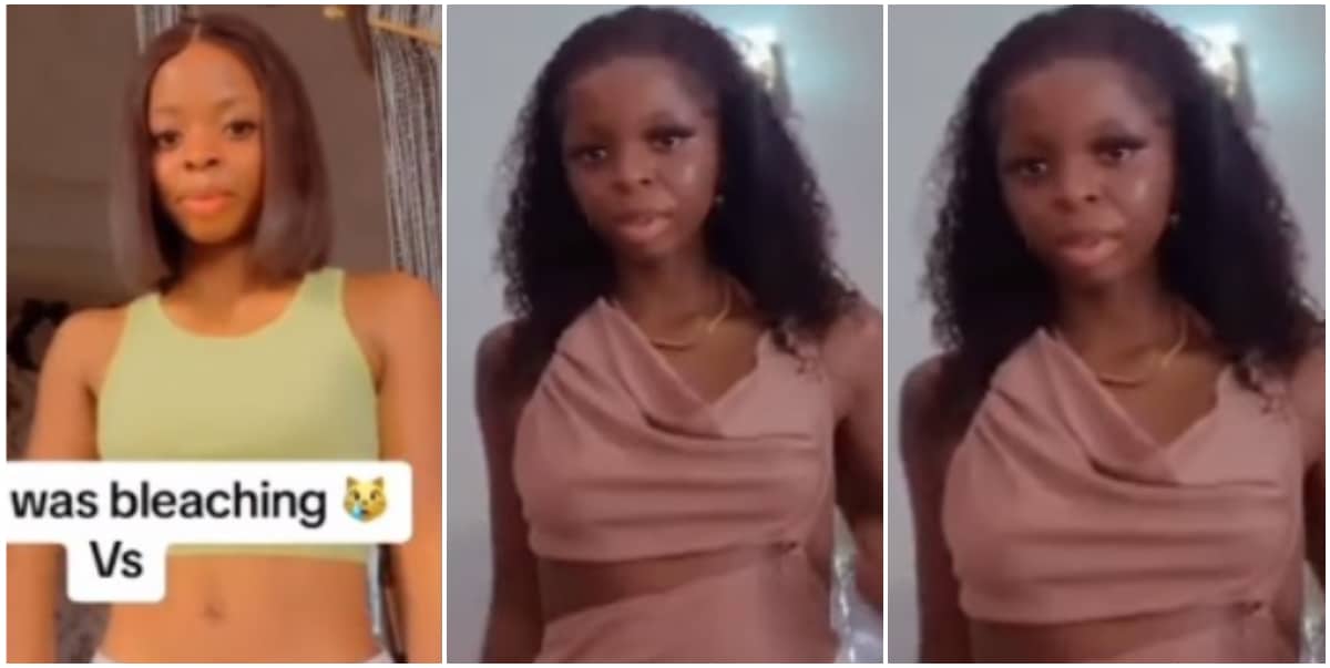 Lady shares before and after photos of her skin after stopping using bleaching cream (Video)