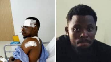 "9 bullets, 3 surgeries" ― Nigerian man marks seven years since he survived brutal armed robbery attack