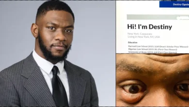 Man shares condition of his eyes after studying 13 hours daily to pass bar exams