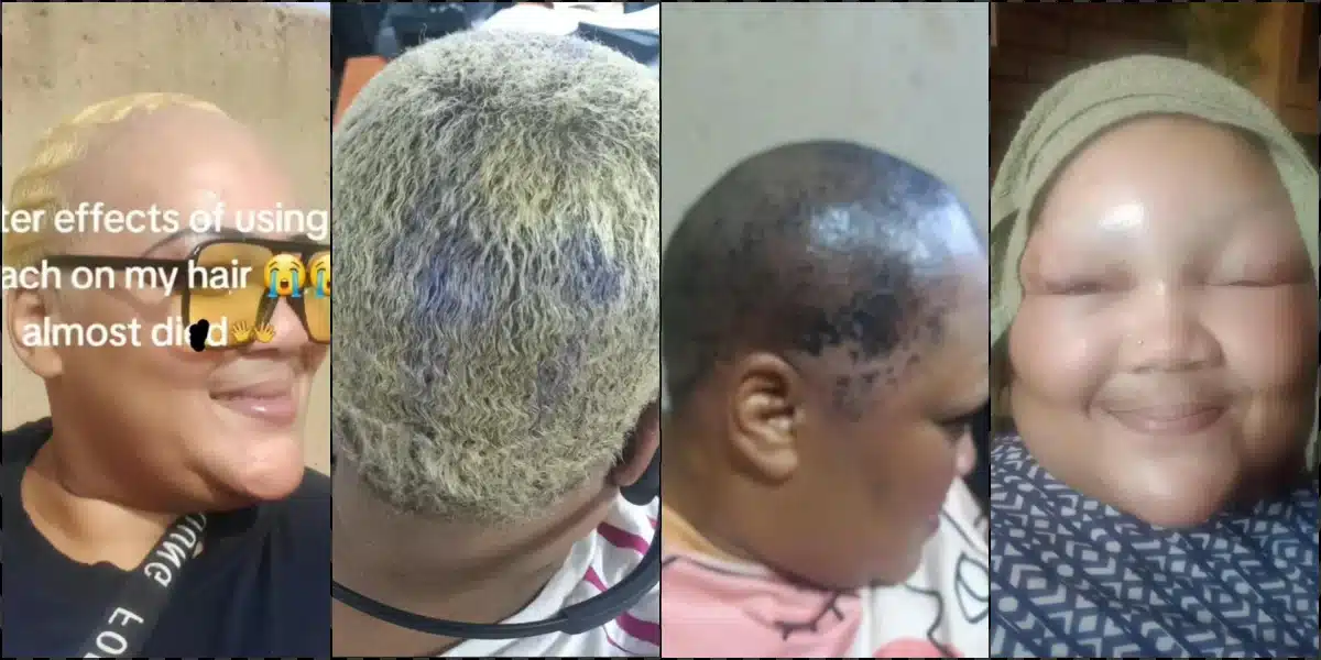 Woman shares aftereffect of bleaching her hair