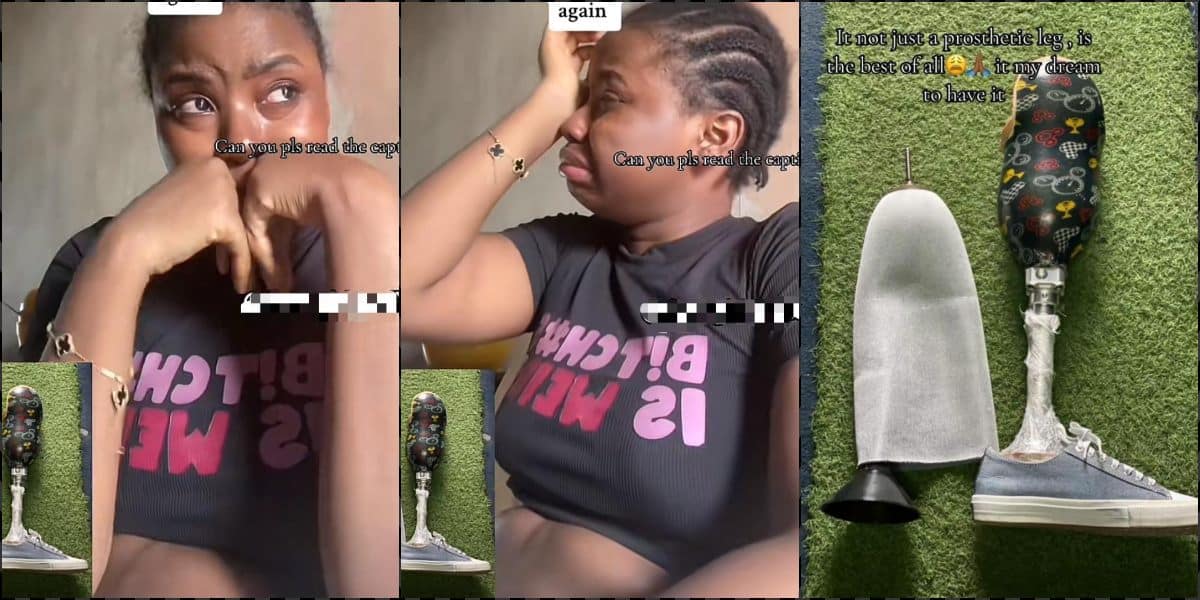 Lady breaks down in tears over inability to afford N3.5M prosthetic leg