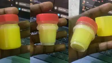 “Daylight robbery” — Man cries out after being deceived by popular ointment packaging