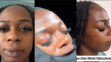 Speculations as lady flaunts result of nose job