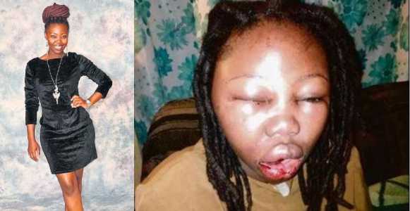 Actress battered by her boyfriend for kissing in a film