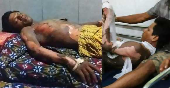 Wife burns her husband alive because he refused to give her his phone's password (photos)