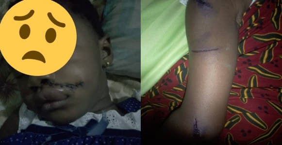 Little Nigerian girl returns from school with deep cuts all over her body (Photos)