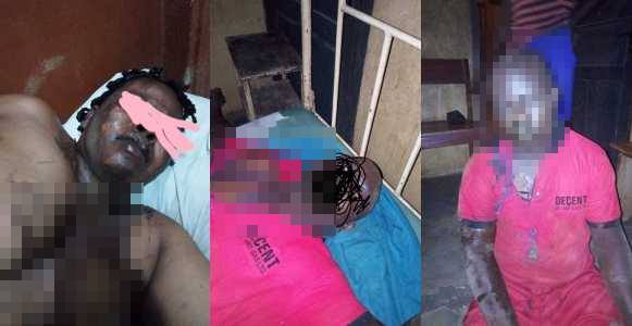 Man bathes wife with acid in Anambra, kills self, because she named their son as next of kin on her land and house