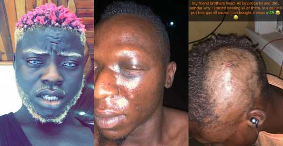 Nigerian pornstar, Tblakhoc and his friends assaulted by policemen in Osun State (Photos/Video)
