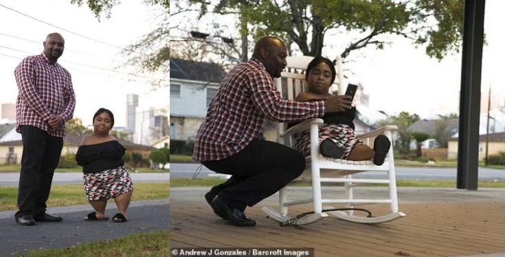 Woman Born With No Arms And Knees Finds Love