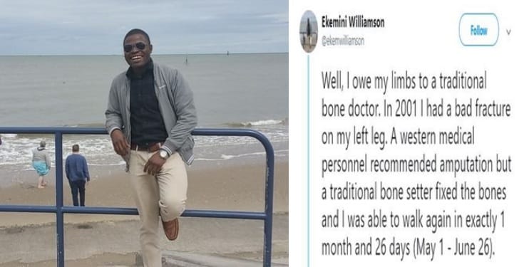 Man reveals how traditional bone setters saved him from amputation