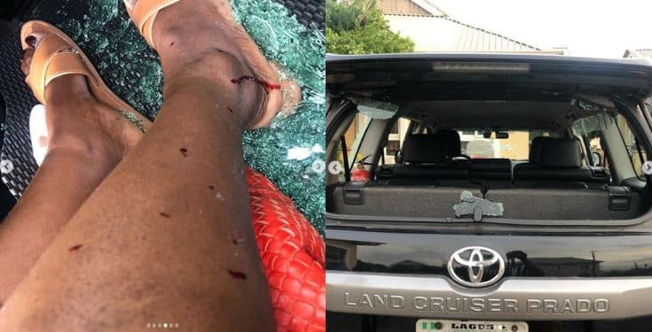 Xenophobia: Lady shares photos of injuries she sustained in Lagos protest