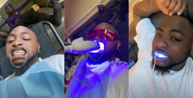 Davido shares photos from his visit to the dentist for teeth whitening (video)