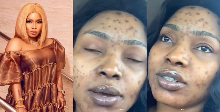 Halima Abubakar bravely shares video showing the condition of her face last year