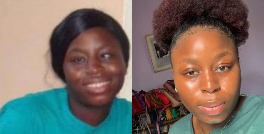 430 eyed lady shares transformation photos after undergoing surgery