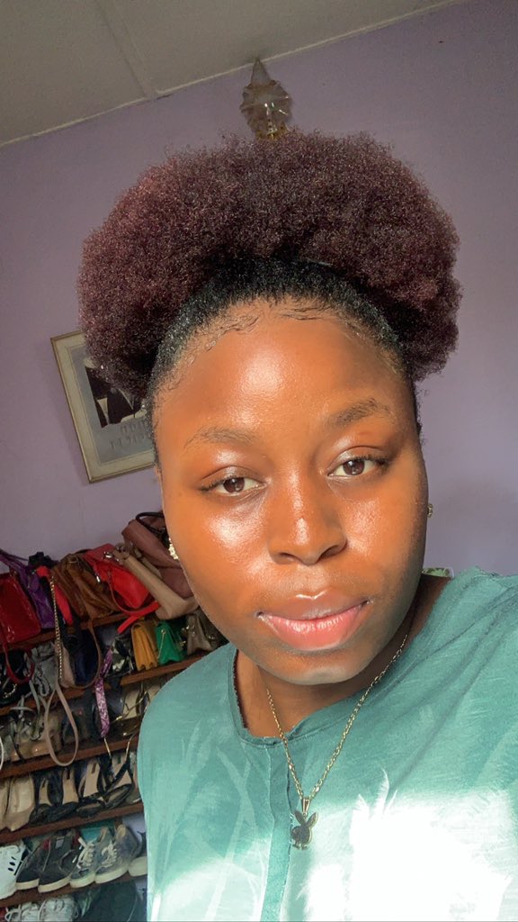 Bullied 4:30 eyed lady shares transformation photos after undergoing surgery