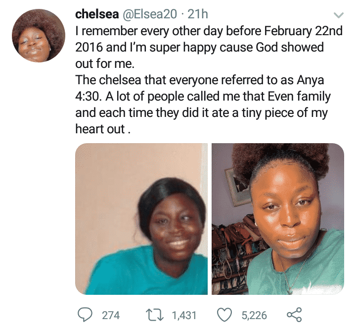 Bullied 4:30 eyed lady shares transformation photos after undergoing surgery