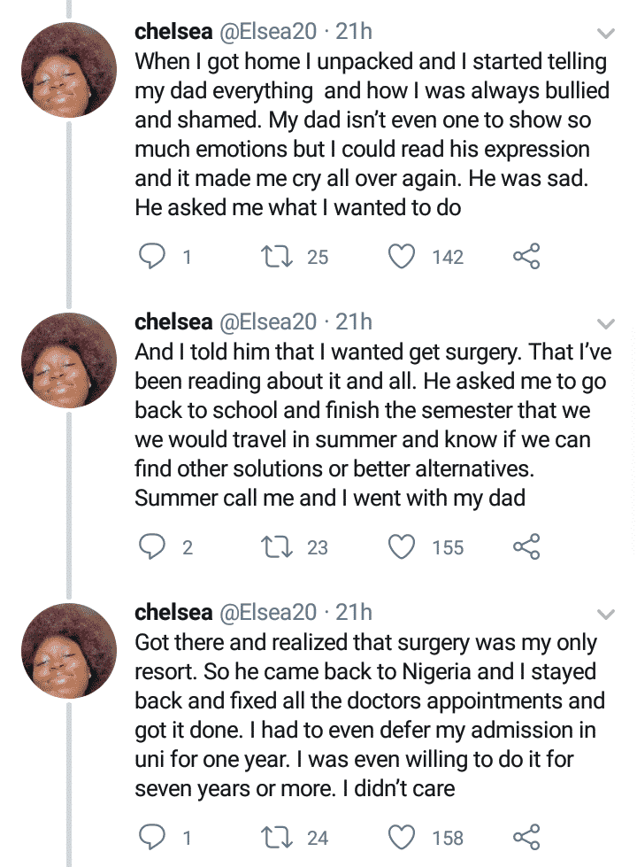 lady with 4:30 eyes shares transformation story after undergoing surgery