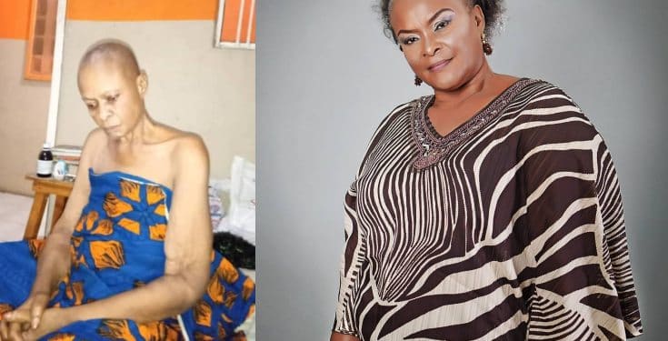 Nollywood actress Ify Onwuemene down with cancer, colleague appeals for help