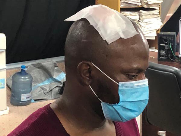 Journalist brutalized by Police during #EndSARS