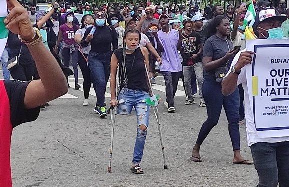 jane endsars protester with one leg