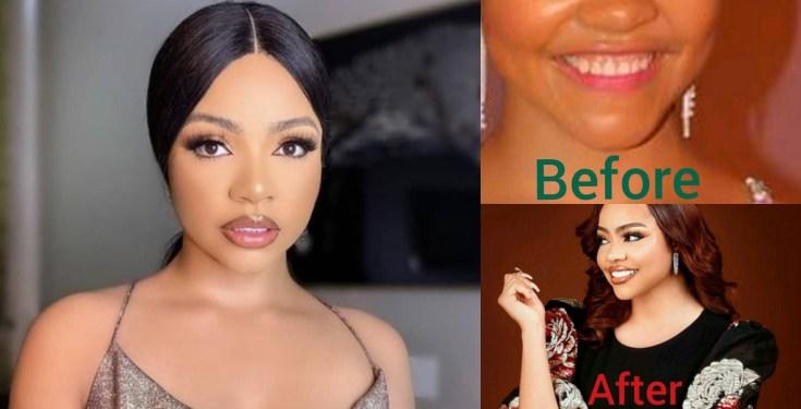 "Nothing is real about you" - Fans drag Nengi as old photo confirms she did teeth surgery