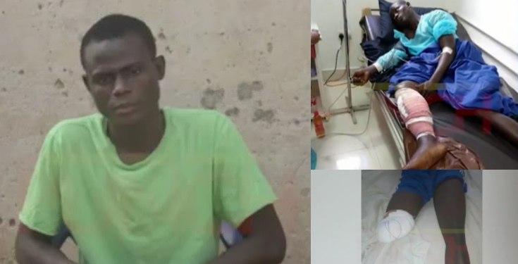 Man whose leg got amputated from gun shot wound at Lekki shooting shares story (Video)