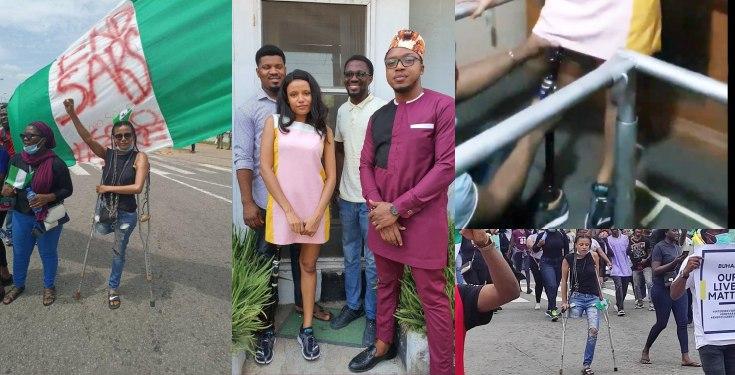 EndSARS Protester Gets New Prosthetic Leg, Plus N1m Donation To Start Business