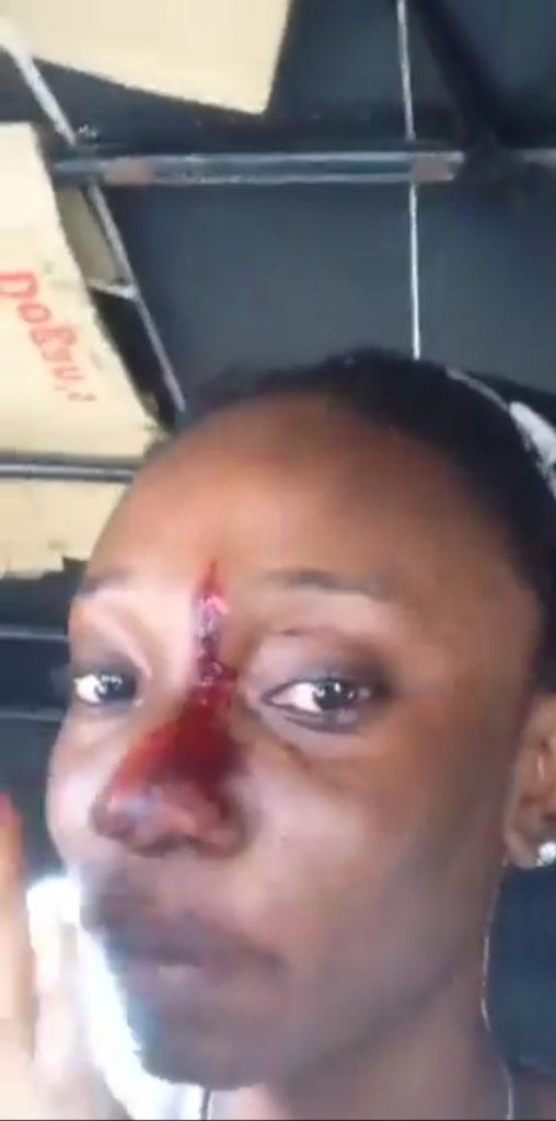 hits lady refusing name