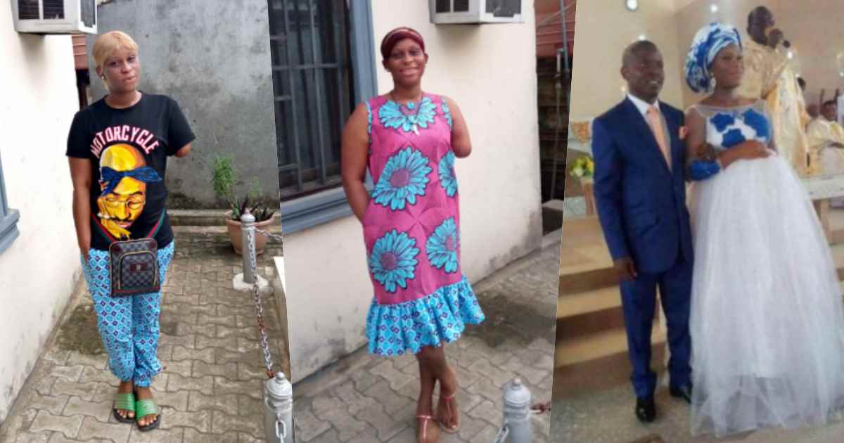 Woman narrates how her husband chopped off her hand over suspicion of infidelity