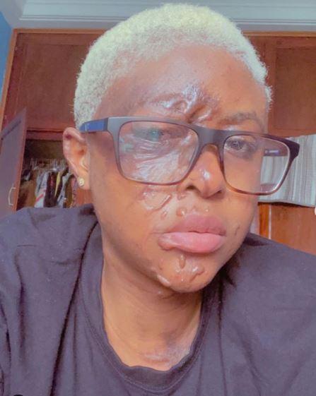 Lady Acid Neighbour Success