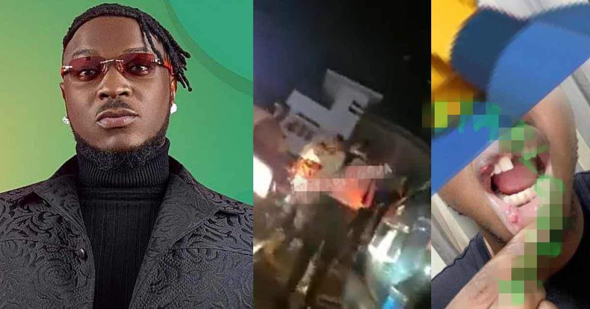 Peruzzi called out after knocking out man's tooth for recording him during a car accident (Video)