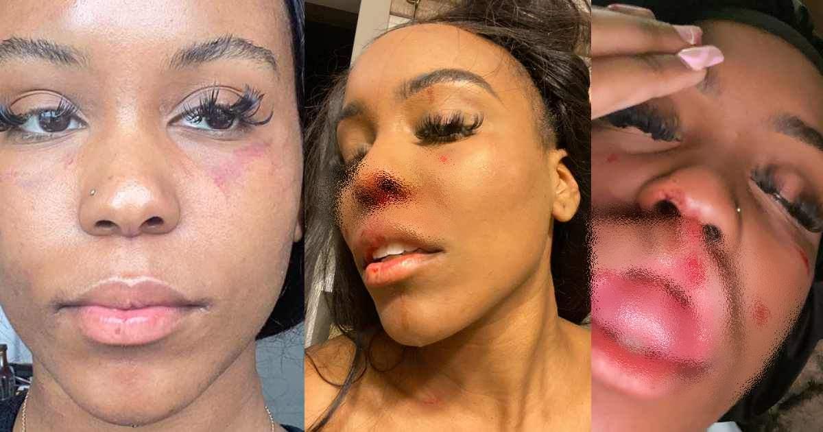 "Domestic violence is real especially in same gender relationship" - Lady cries out after being battered by her girlfriend