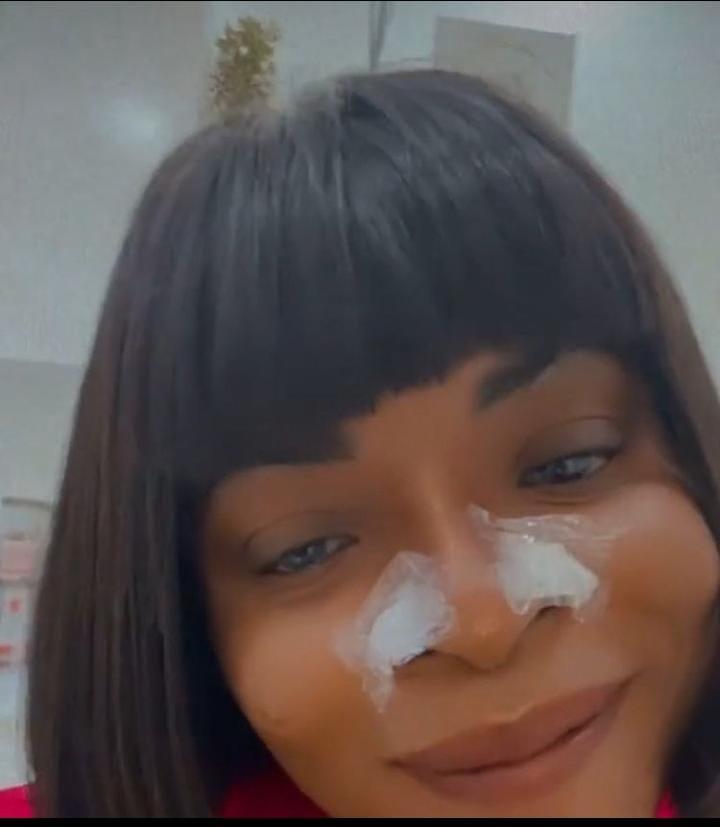 Laura Ikeji nose job