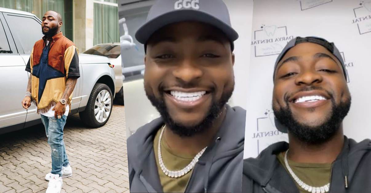 “I no close mouth again” - Davido says as he shows off new set of teeth (Video)