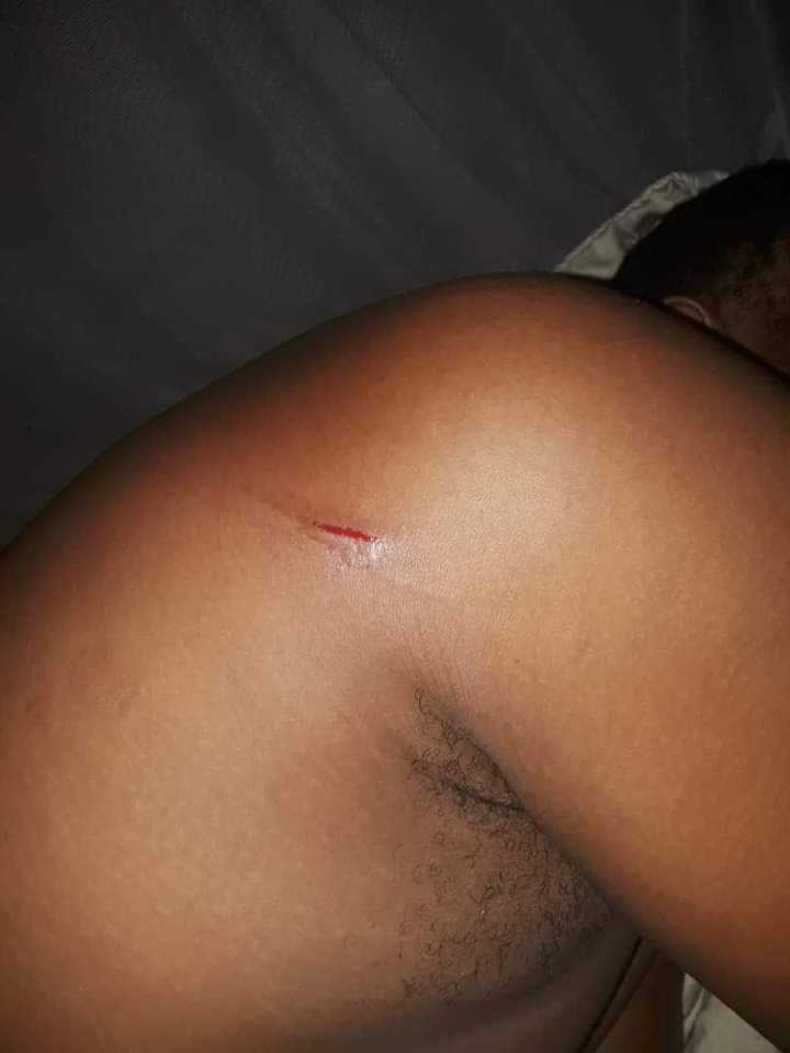 "Pray for me" - Man pleads, narrates how dream knife cut appeared on his body upon waking up