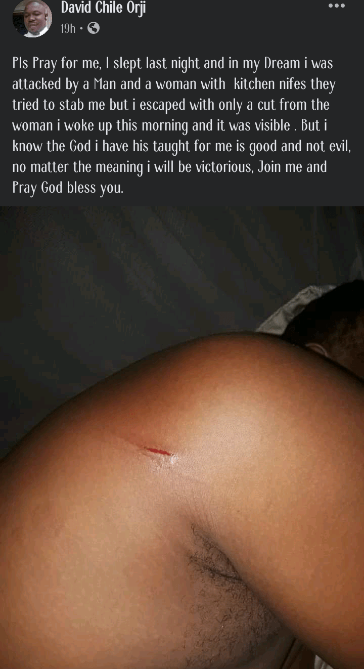 "Pray for me" - Man pleads, narrates how dream knife cut appeared on his body upon waking up