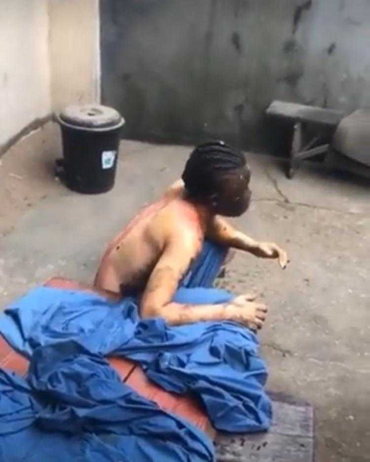 Woman suffers severe burn after setting ex-boyfriend on fire during wedding to another woman in Abia