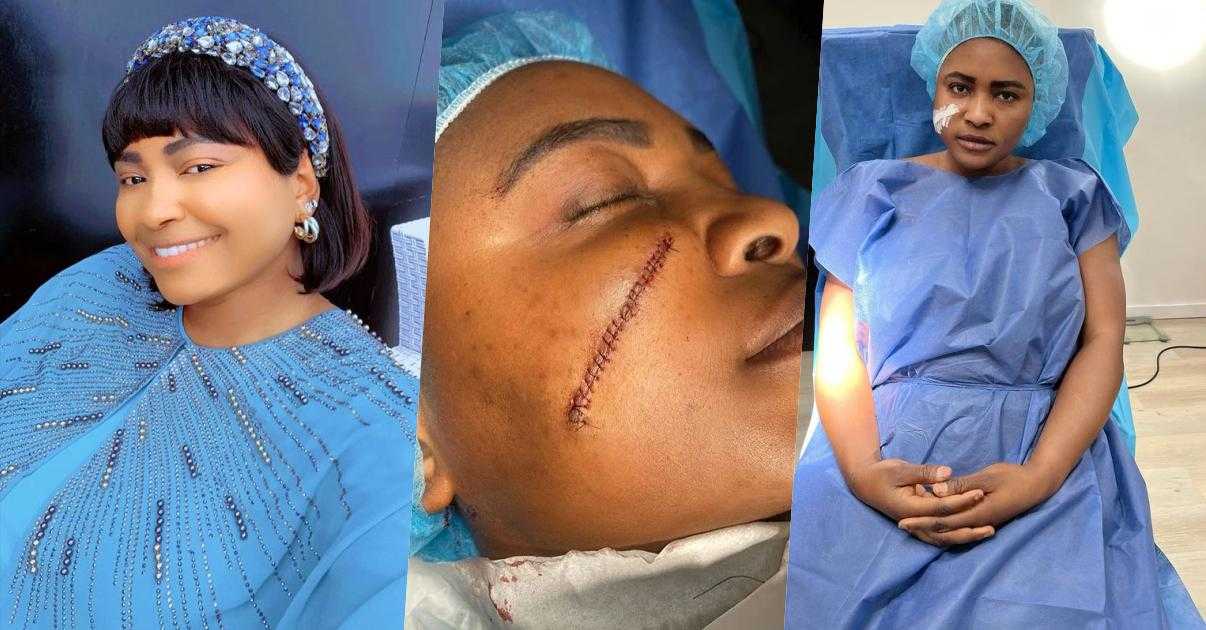 How I lost confidence because of scar on my face - Sonia Ogiri narrates as she undergoes surgery