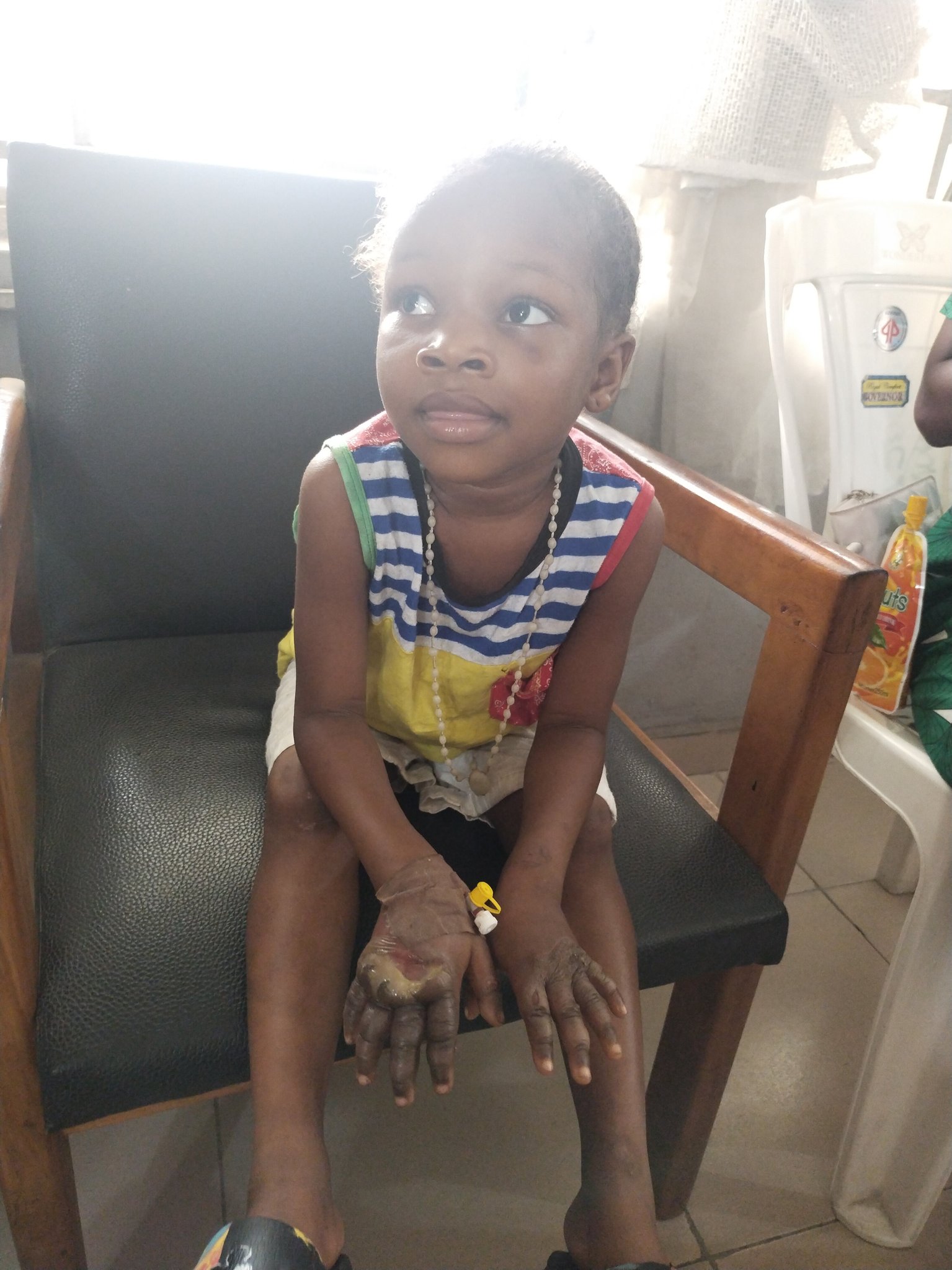 Mother dips five-year-old daughter's hands in hot water for eating 18 out of 19 fishes meant to be sold