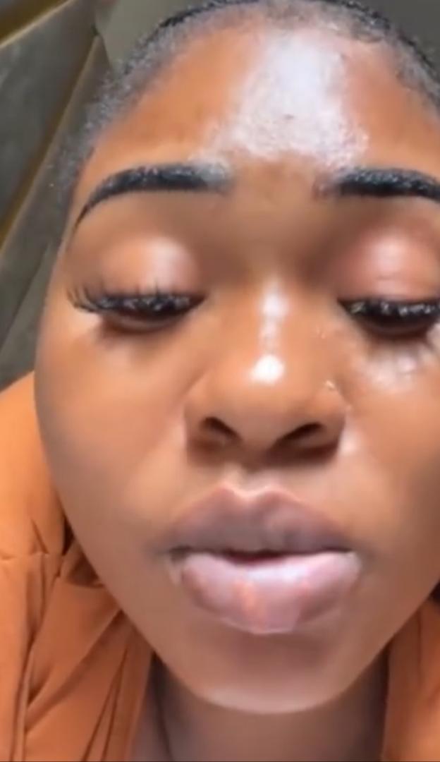 "What did I put myself into? Fine girl like me" - Lady ends up with swollen lips after pink lips procedure (Video)