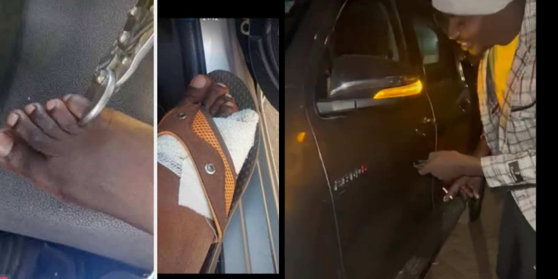 Rising cost of living allegedly forcing Zimbabwean citizens to cut and sell off their toes [Photos/Video]