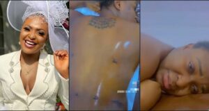 "Price just went up" - Blessing Okoro cries in pain as she shows off healing progress of plastic surgery (Video)