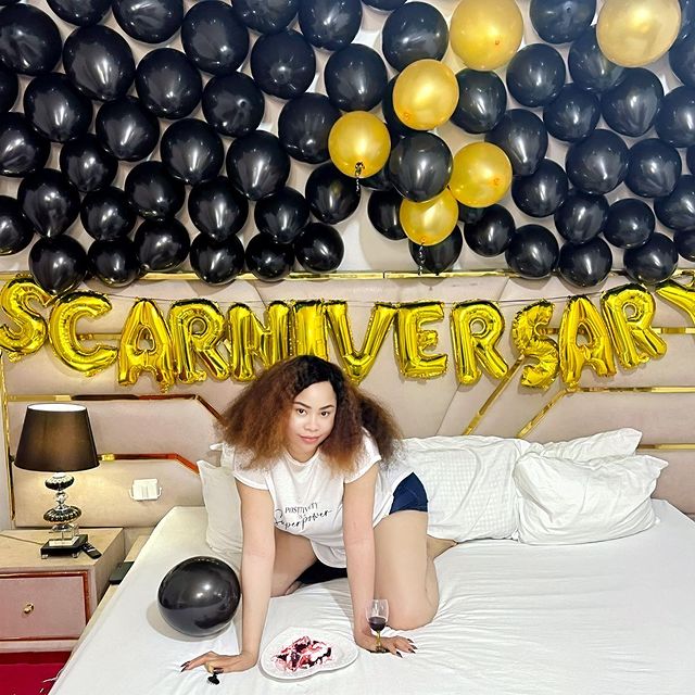 Precious Chikwendu scarniversary