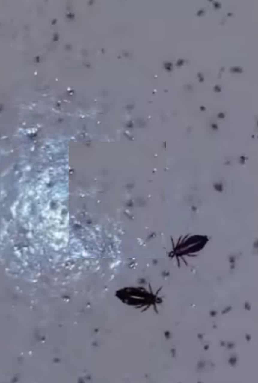 Lady in shock at the sight of lice harvested from her hair (Video)