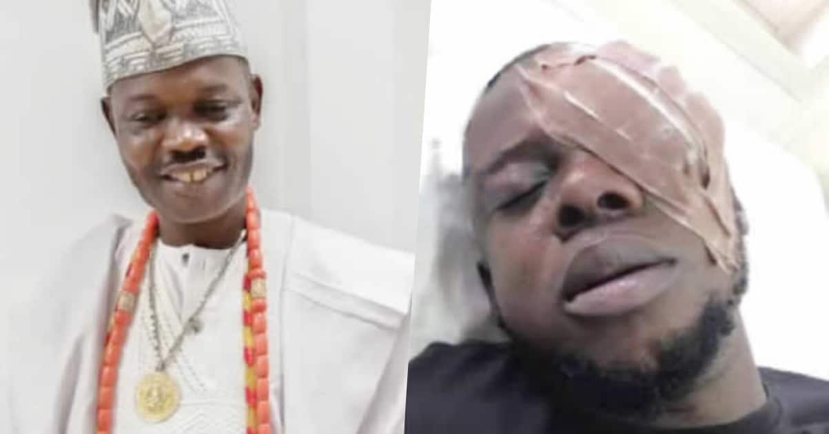 Man allegedly blinded by Ogun monarch for dancing with the Queen