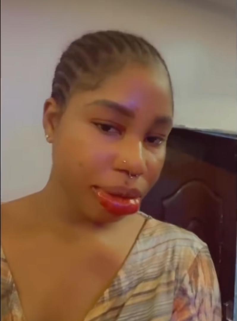 "I never knew it'd be like this" — Lady laments after attempt to get pink lips (Video)