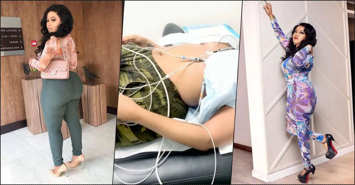 Vera Sidika pleads against plastic surgery as she battles complication from past body enhancement (Video)